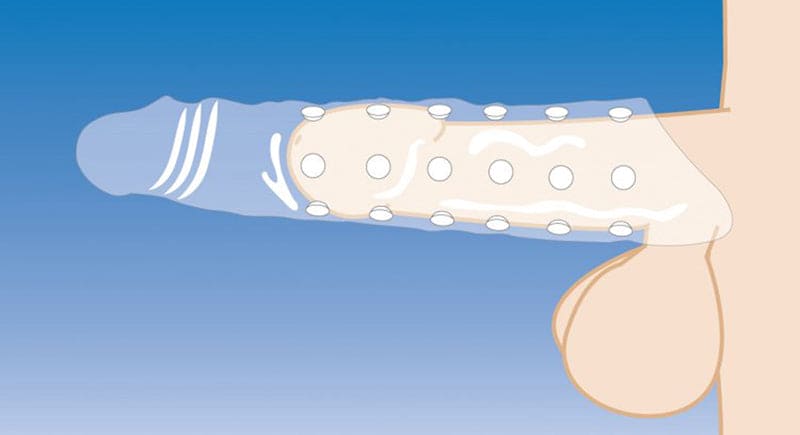 Extender Penis Sleeve With Dots - Transparent